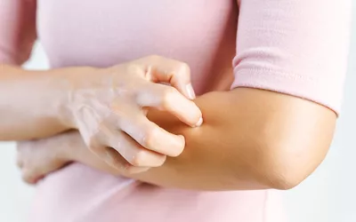 A person scratching their forearm, showing signs of skin irritation and inflammation.