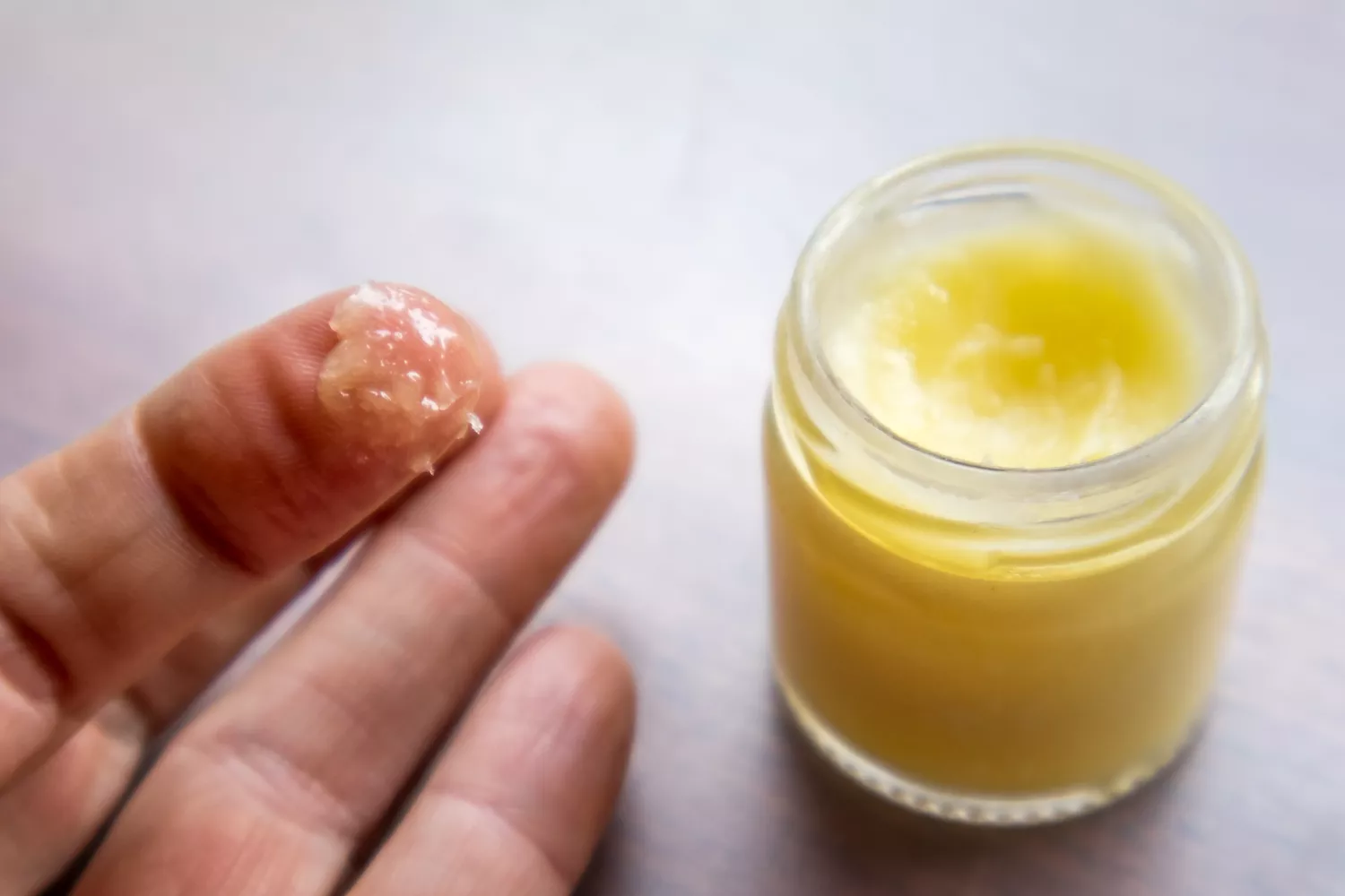 An image of ointment made with coconut and essential oils used for topical recovery.