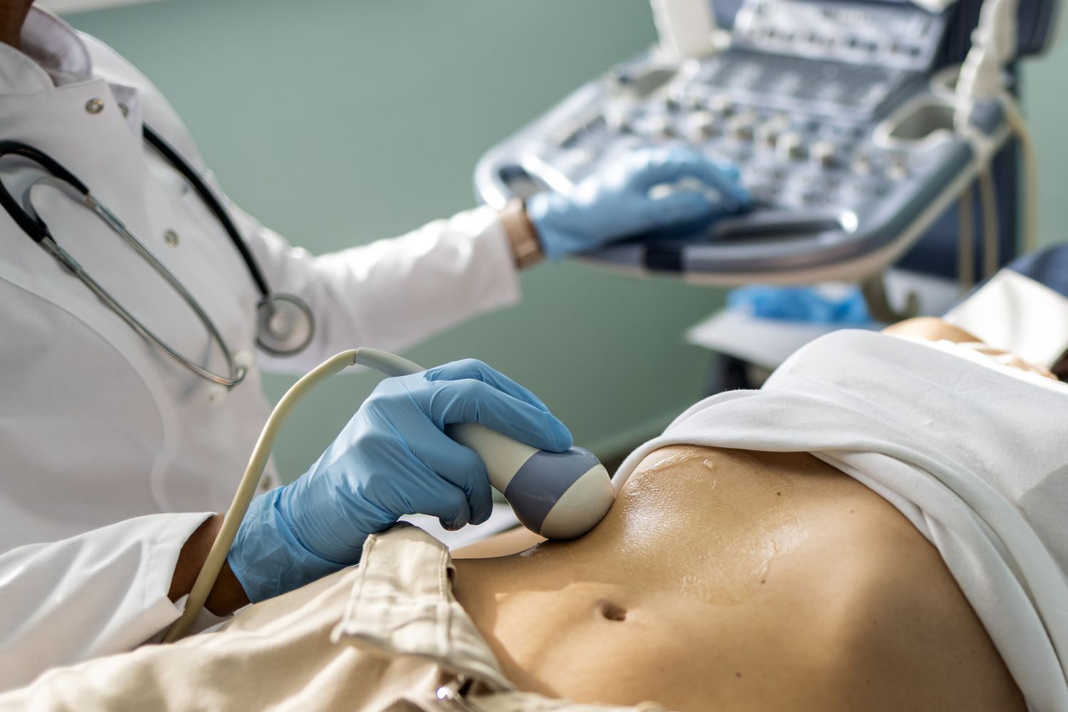 Gallbladder Sludge: Why It Matters Without Pain