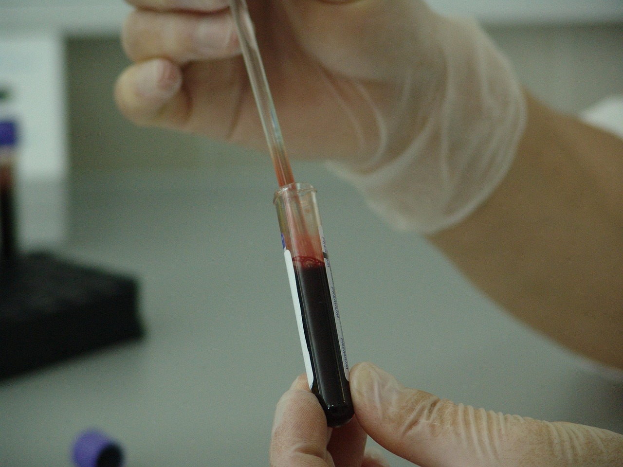 A professional medical setting with a blood sample and laboratory equipment.